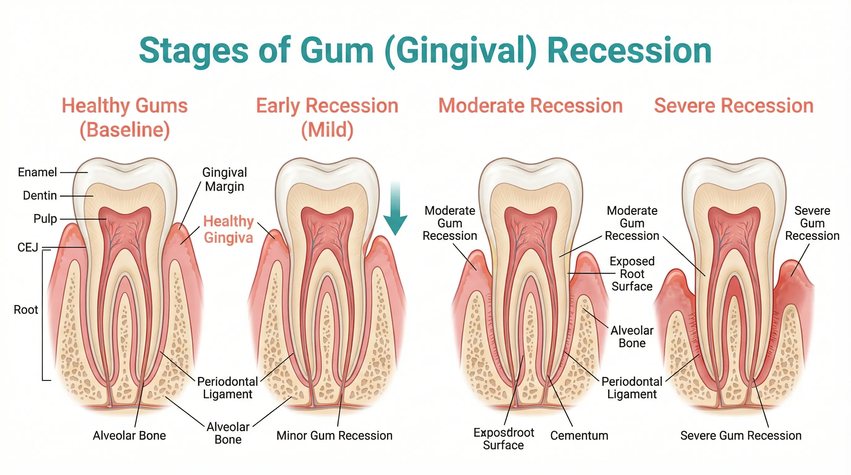 Top supplements for supporting receding gum health